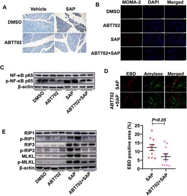 Adenosine Kinase Inhibition Prevents Severe Acute Pancreatitis via Suppressing Inflammation and Acinar Cell Necroptosis